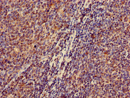 Immunohistochemistry of paraffin-embedded human lymph node tissue using CSB-PA861122LA01HU at dilution of 1:100