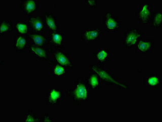 Immunofluorescent analysis of U251 cells using CSB-PA862002LA01HU at dilution of 1:100 and Alexa Fluor 488-congugated AffiniPure Goat Anti-Rabbit IgG(H+L) Immunofluorescent analysis of U251 cells using CSB-PA862002LA01HU at dilution of 1:100 and Alexa Fluor 488-congugated AffiniPure Goat Anti-Rabbit IgG(H+L)