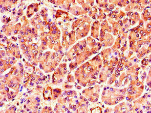 Immunohistochemistry of paraffin-embedded human pancreatic tissue using CSB-PA862070LA01HU at dilution of 1:100