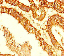 CSB-PA872489HA01HU