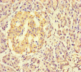 CSB-PA872489HA01HU