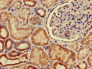 Immunohistochemistry of paraffin-embedded human kidney tissue using CSB-PA873638LA01HU at dilution of 1:100