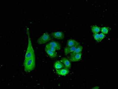Immunofluorescent analysis of HepG2 cells using CSB-PA882091LA01HU at dilution of 1:100 and Alexa Fluor 488-congugated AffiniPure Goat Anti-Rabbit IgG(H+L)