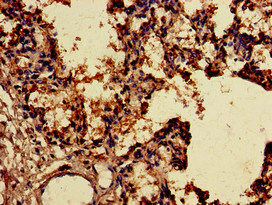 Immunohistochemistry of paraffin-embedded human lung tissue using CSB-PA882091LA01HU at dilution of 1:100