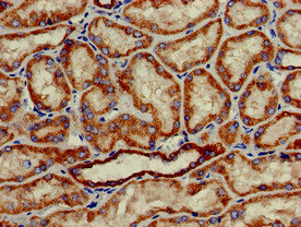 Immunohistochemistry of paraffin-embedded human kidney tissue using CSB-PA882145LA01HU at dilution of 1:100 Immunohistochemistry of paraffin-embedded human kidney tissue using CSB-PA882145LA01HU at dilution of 1:100