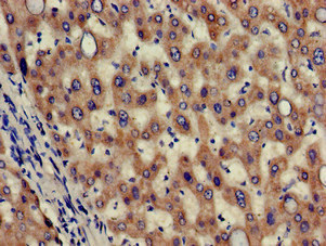Immunohistochemistry of paraffin-embedded human liver tissue using CSB-PA882145LA01HU at dilution of 1:100 Immunohistochemistry of paraffin-embedded human liver tissue using CSB-PA882145LA01HU at dilution of 1:100