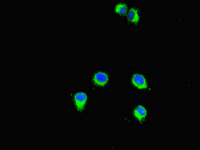 Immunofluorescent analysis of Hela cells using CSB-PA885705LA01HU at dilution of 1:100 and Alexa Fluor 488-congugated AffiniPure Goat Anti-Rabbit IgG(H+L)