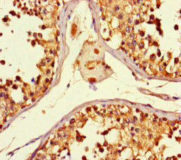 Immunohistochemistry of paraffin-embedded human testis tissue using CSB-PA885705LA01HU at dilution of 1:100 Immunohistochemistry of paraffin-embedded human testis tissue using CSB-PA885705LA01HU at dilution of 1:100