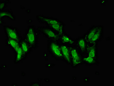 Immunofluorescence(IF) - SMARCAL1 Antibody
