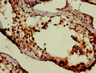 Immunohistochemistry of paraffin-embedded human testis tissue using CSB-PA889104LA01HU at dilution of 1:100