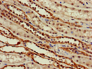 Immunohistochemistry of paraffin-embedded human kidney tissue using CSB-PA889104LA01HU at dilution of 1:100