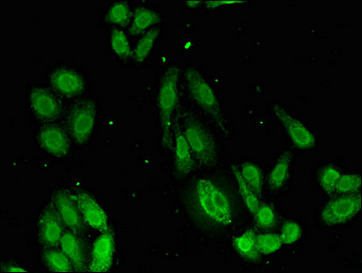 Immunofluorescent analysis of HepG2 cells using CSB-PA891784LA01HU at dilution of 1:100 and Alexa Fluor 488-congugated AffiniPure Goat Anti-Rabbit IgG(H+L)