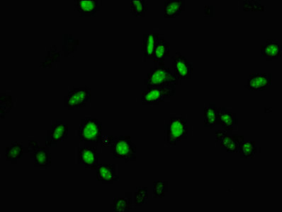 Immunofluorescent analysis of Hela cells using CSB-PA891982LA01HU at dilution of 1:100 and Alexa Fluor 488-congugated AffiniPure Goat Anti-Rabbit IgG(H+L)