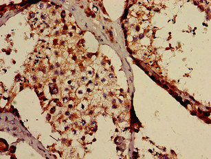 CSB-PA896758LA01HU