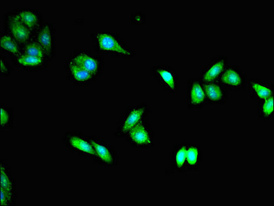 Immunofluorescence(IF) - TACC3 Antibody