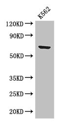 Western Blot Positive WB detected in: K562 whole cell lysate All lanes: BTRC antibody at 2.8microg/ml Secondary Goat polyclonal to rabbit IgG at 1/50000 dilution Predicted band size: 69, 66 kDa Observed band size: 69 kDa