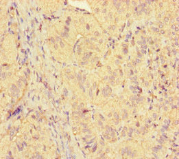 Immunohistochemistry of paraffin-embedded human adrenal gland tissue using CSB-PA897466LA01HU at dilution of 1:100 Immunohistochemistry of paraffin-embedded human adrenal gland tissue using CSB-PA897466LA01HU at dilution of 1:100