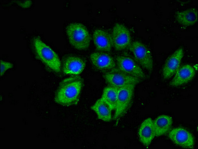 Immunofluorescent analysis of A549 cells using CSB-PA897591LA01HU at dilution of 1:100 and Alexa Fluor 488-congugated AffiniPure Goat Anti-Rabbit IgG(H+L)
