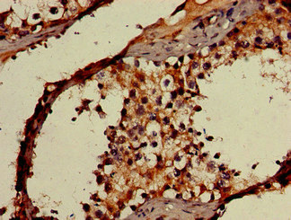 Immunohistochemistry of paraffin-embedded human testis tissue using CSB-PA897591LA01HU at dilution of 1:100 Immunohistochemistry of paraffin-embedded human testis tissue using CSB-PA897591LA01HU at dilution of 1:100