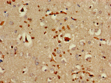 Immunohistochemistry of paraffin-embedded human brain tissue using CSB-PA897591LA01HU at dilution of 1:100
