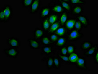 Immunofluorescence(IF) - ACADVL Antibody