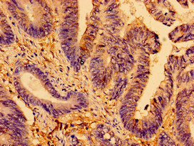 CSB-PA001681LA01HU