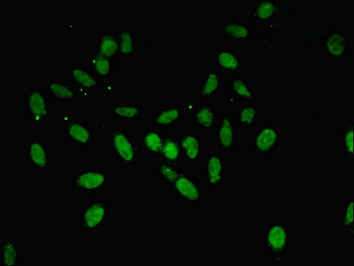 Immunofluorescent analysis of Hela cells using CSB-PA001838ESR2HU at dilution of 1:100 and Alexa Fluor 488-congugated AffiniPure Goat Anti-Rabbit IgG(H+L)