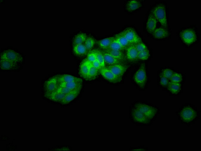 Immunofluorescence staining of HepG2 cells with CSB-PA002146LA01HU at 1:133, counter-stained with DAPI. The cells were fixed in 4% formaldehyde, permeabilized using 0.2% Triton X-100 and blocked in 10% normal Goat Serum. The cells were then incubated with the antibody overnight at 4°C. The secondary antibody was Alexa Fluor 488-congugated AffiniPure Goat Anti-Rabbit IgG(H+L). Immunofluorescence staining of HepG2 cells with CSB-PA002146LA01HU at 1:133, counter-stained with DAPI. The cells were fixed in 4% formaldehyde, permeabilized using 0.2% Triton X-100 and blocked in 10% normal Goat Serum. The cells were then incubated with the antibody overnight at 4°C. The secondary antibody was Alexa Fluor 488-congugated AffiniPure Goat Anti-Rabbit IgG(H+L).