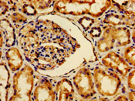 CSB-PA002470LA01HU