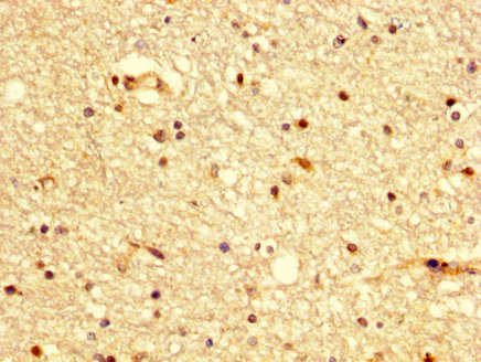 IHC image of CSB-PA002652LA01HU diluted at 1:300 and staining in paraffin-embedded human brain tissue performed on a Leica BondTM system. After dewaxing and hydration, antigen retrieval was mediated by high pressure in a citrate buffer (pH 6.0). Section was blocked with 10% normal goat serum 30min at RT. Then primary antibody (1% BSA) was incubated at 4°C overnight. The primary is detected by a biotinylated secondary antibody and visualized using an HRP conjugated SP system.