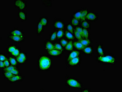 Immunofluorescent analysis of HepG2 cells using CSB-PA004769ESR2HU at dilution of 1:100 and Alexa Fluor 488-congugated AffiniPure Goat Anti-Rabbit IgG(H+L)