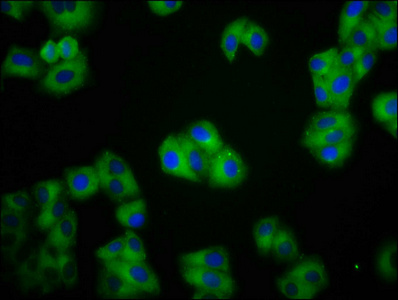 Immunofluorescence(IF) - CDH1 Antibody