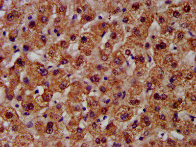 IHC image of CSB-PA005913LA01HU diluted at 1:300 and staining in paraffin-embedded human liver tissue performed on a Leica BondTM system. After dewaxing and hydration, antigen retrieval was mediated by high pressure in a citrate buffer (pH 6.0). Section was blocked with 10% normal goat serum 30min at RT. Then primary antibody (1% BSA) was incubated at 4°C overnight. The primary is detected by a biotinylated secondary antibody and visualized using an HRP conjugated SP system.