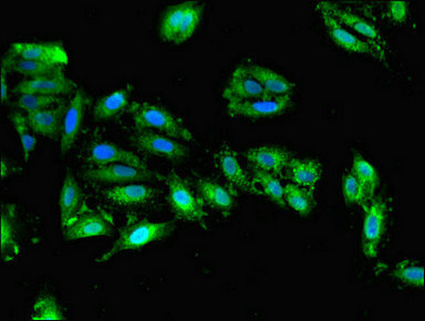Immunofluorescent analysis of Hela cells using CSB-PA006847HA01HU at dilution of 1:100 and Alexa Fluor 488-congugated AffiniPure Goat Anti-Rabbit IgG(H+L)