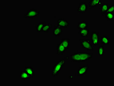 Immunofluorescent analysis of A549 cells using CSB-PA006867DA01HU at dilution of 1:100 and Alexa Fluor 488-congugated AffiniPure Goat Anti-Rabbit IgG(H+L)