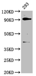 Western Blot Positive WB detected in: 293 whole cell lysate All lanes: DHX15 antibody at 3.7microg/ml Secondary Goat polyclonal to rabbit IgG at 1/50000 dilution Predicted band size: 91 kDa Observed band size: 91 kDa