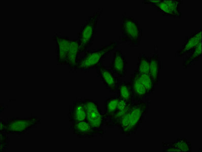 Immunofluorescent analysis of Hela cells using CSB-PA006919LA01HU at dilution of 1:100 and Alexa Fluor 488-congugated AffiniPure Goat Anti-Rabbit IgG(H+L)