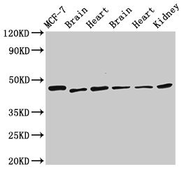 Western Blot Positive WB detected in: MCF-7 whole cell lysate, Rat brain tissue, Rat heart tissue, Mouse brain tissue, Mouse heart tissue, Mouse kidney tissue All lanes: DKC1 antibody at 2.5microg/ml Secondary Goat polyclonal to rabbit IgG at 1/50000 dilution Predicted band size: 58, 48 kDa Observed band size: 48 kDa