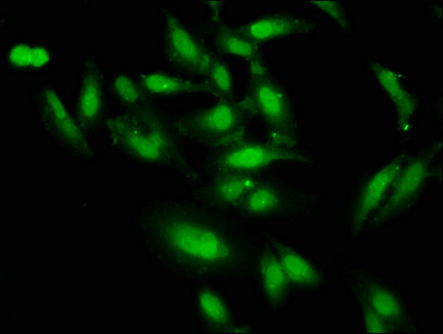 Immunofluorescence staining of Hela cells with CSB-PA006952LA01HU at 1:66, counter-stained with DAPI. The cells were fixed in 4% formaldehyde, permeabilized using 0.2% Triton X-100 and blocked in 10% normal Goat Serum. The cells were then incubated with the antibody overnight at 4°C. The secondary antibody was Alexa Fluor 488-congugated AffiniPure Goat Anti-Rabbit IgG(H+L).