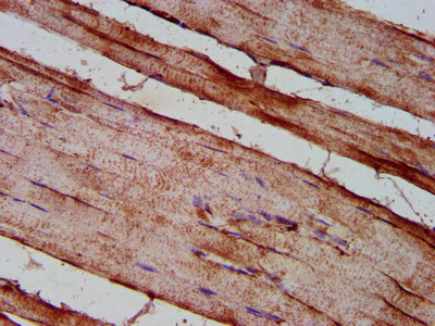 IHC image of CSB-PA006963LA01HU diluted at 1:200 and staining in paraffin-embedded human skeletal muscle tissue performed on a Leica BondTM system. After dewaxing and hydration, antigen retrieval was mediated by high pressure in a citrate buffer (pH 6.0). Section was blocked with 10% normal goat serum 30min at RT. Then primary antibody (1% BSA) was incubated at 4°C overnight. The primary is detected by a biotinylated secondary antibody and visualized using an HRP conjugated SP system.