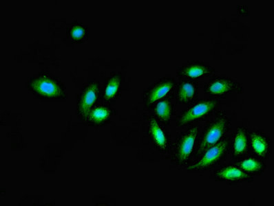 Immunofluorescent analysis of A549 cells using CSB-PA007047LA01HU at dilution of 1:100 and Alexa Fluor 488-congugated AffiniPure Goat Anti-Rabbit IgG(H+L)