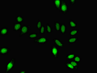 Immunofluorescent analysis of A549 cells using CSB-PA007062LA01HU at dilution of 1:100 and Alexa Fluor 488-congugated AffiniPure Goat Anti-Rabbit IgG(H+L)