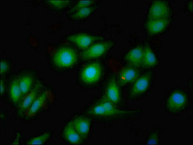 CSB-PA007178LA01HU