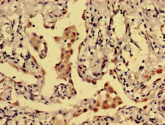 CSB-PA007178LA01HU