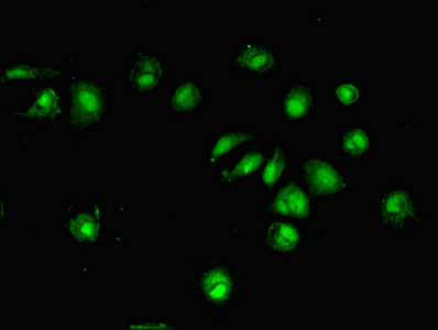 Immunofluorescent analysis of MCF-7 cells using CSB-PA007219EA01HU at dilution of 1:100 and Alexa Fluor 488-congugated AffiniPure Goat Anti-Rabbit IgG(H+L)