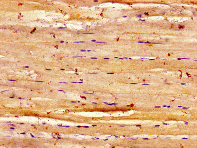 CSB-PA007314LA01HU IHC-2