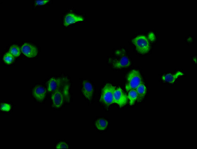 Immunofluorescence staining of MCF-7 cells with CSB-PA007649LA01HU at 1:133, counter-stained with DAPI. The cells were fixed in 4% formaldehyde, permeabilized using 0.2% Triton X-100 and blocked in 10% normal Goat Serum. The cells were then incubated with the antibody overnight at 4°C. The secondary antibody was Alexa Fluor 488-congugated AffiniPure Goat Anti-Rabbit IgG(H+L).