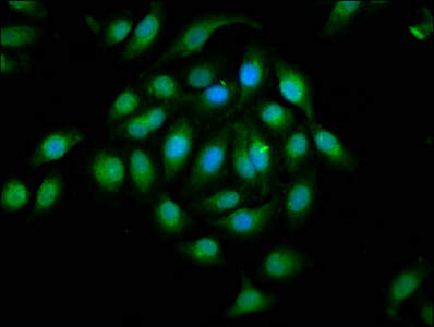 Immunofluorescence(IF) - EPHA2 Antibody