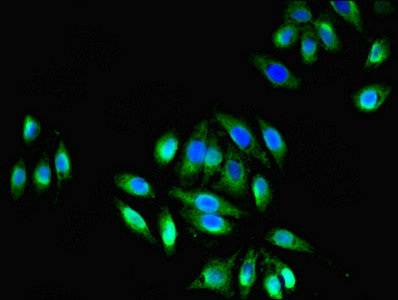 Immunofluorescent analysis of A549 cells using CSB-PA007779LA01HU at dilution of 1:100 and Alexa Fluor 488-congugated AffiniPure Goat Anti-Rabbit IgG(H+L)
