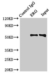 Immunoprecipitating ERG in Rat heart tissue Lane 1: Rabbit control IgG (1microg) instead of CSB-PA007781HA01HU in Rat heart tissue. For western blotting, a HRP-conjugated Protein G antibody was used as the secondary antibody (1/2000) Lane 2: CSB-PA007781HA01HU (8microg) + Rat heart tissue (500microg) Lane 3: Rat heart tissue (10microg)